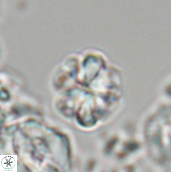 Sphenolithus primus 28709