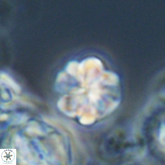 Sphenolithus primus 28711