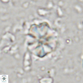Sphenolithus primus 43050