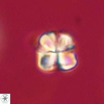 Sphenolithus primus 64299