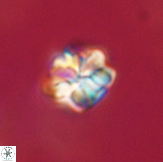 Sphenolithus primus 64303