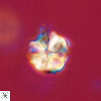 Sphenolithus primus 64326