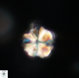 Sphenolithus primus 64327