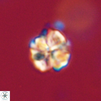 Sphenolithus primus 64323