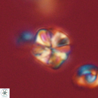 Sphenolithus primus 60155