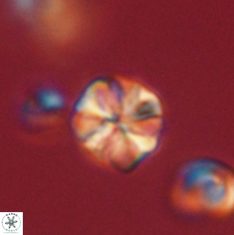 Sphenolithus primus 60156
