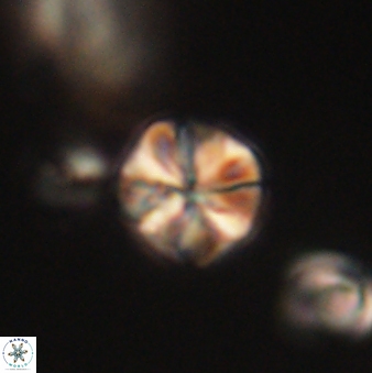 Sphenolithus primus 60157