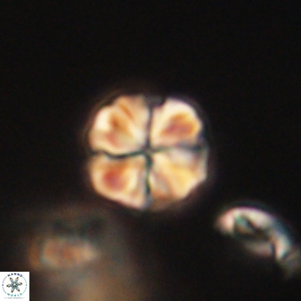 Sphenolithus primus 60158