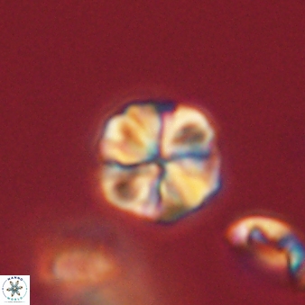 Sphenolithus primus 60159