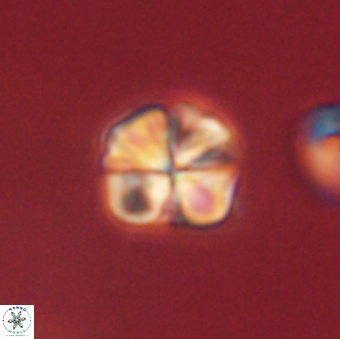 Sphenolithus primus 60167