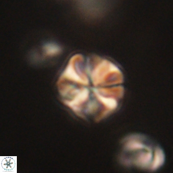 Sphenolithus primus 60161