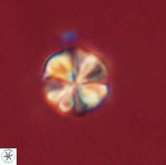 Sphenolithus primus 60175
