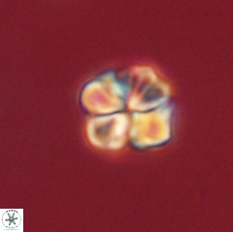 Sphenolithus primus 60176