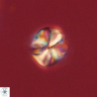 Sphenolithus primus 60179