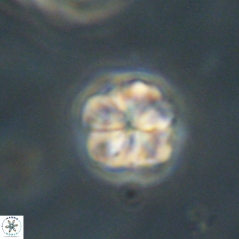 Sphenolithus primus 60184