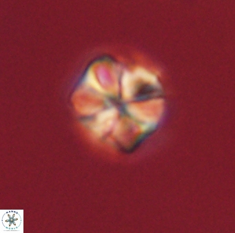 Sphenolithus primus 60180