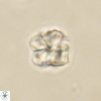 Sphenolithus primus 60182