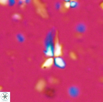 Sphenolithus procerus 28055
