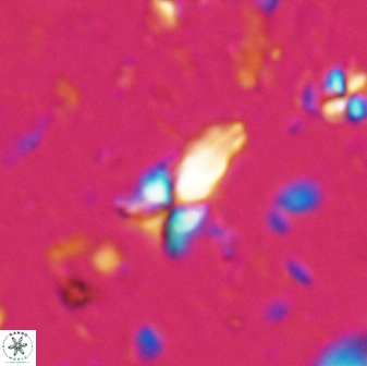 Sphenolithus procerus 28056