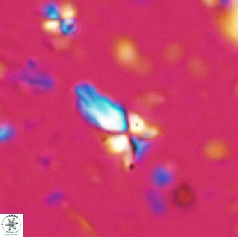 Sphenolithus procerus 28059