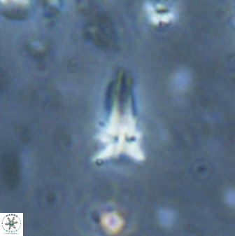 Sphenolithus procerus 28061