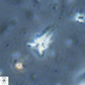 Sphenolithus procerus 28062