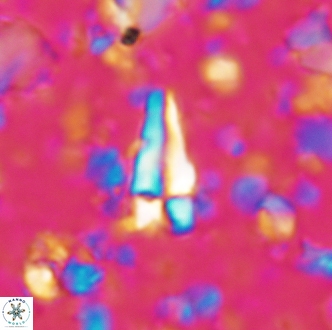 Sphenolithus cubaensis 2002