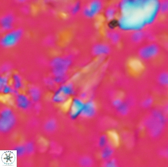 Sphenolithus cubaensis 2003