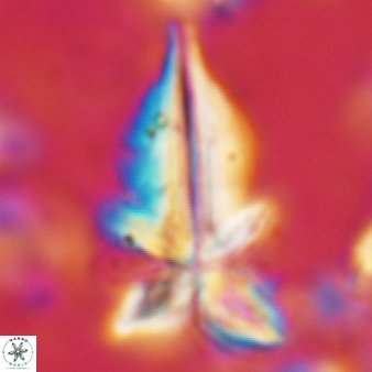 Sphenolithus pseudoradians 143