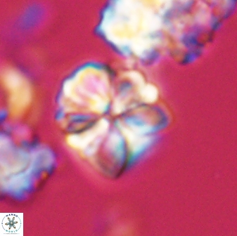 Sphenolithus puniceus 28919