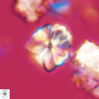 Sphenolithus puniceus 28922