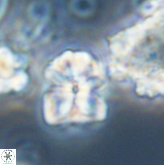 Sphenolithus puniceus 28925