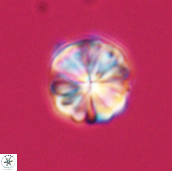 Sphenolithus puniceus 30422