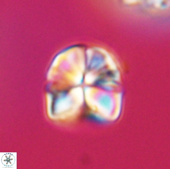 Sphenolithus puniceus 30423