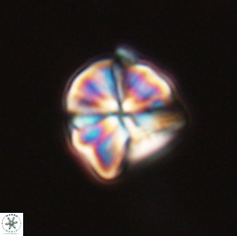 Sphenolithus puniceus 30429