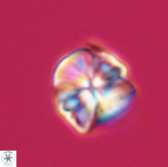 Sphenolithus puniceus 30430