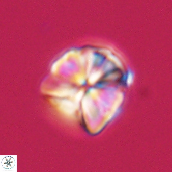 Sphenolithus puniceus 30432