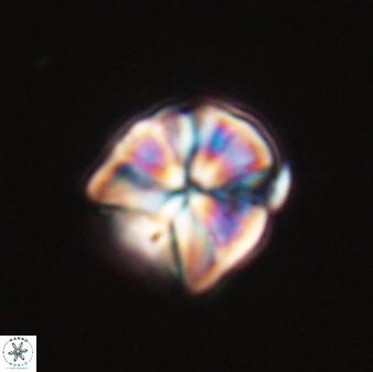 Sphenolithus puniceus 30433