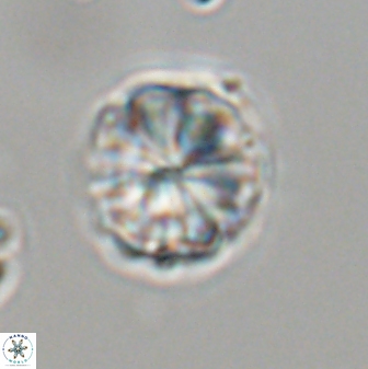 Sphenolithus puniceus 30436