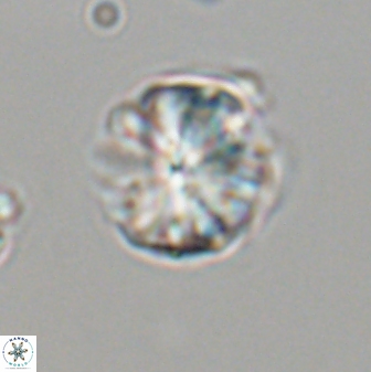 Sphenolithus puniceus 30437