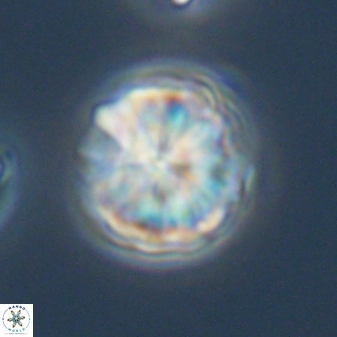 Sphenolithus puniceus 30438