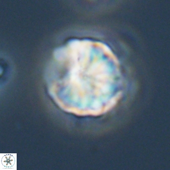 Sphenolithus puniceus 30439