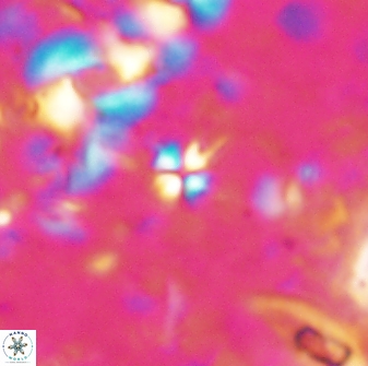 Sphenolithus quadrispinatus 43444