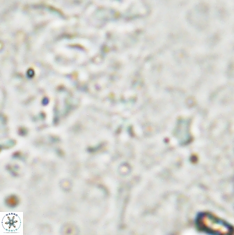 Sphenolithus quadrispinatus 43445