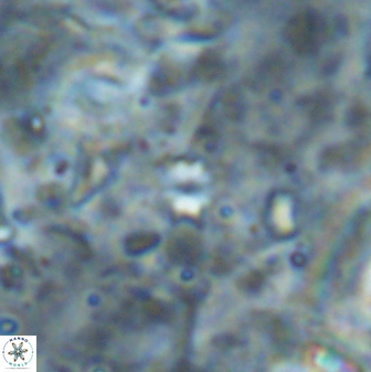 Sphenolithus quadrispinatus 43448