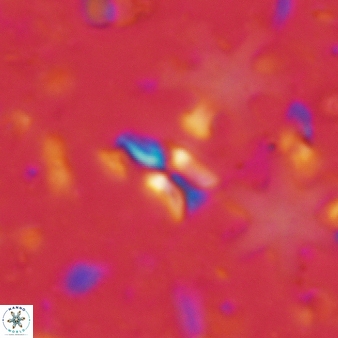 Sphenolithus quasibelemnos 86