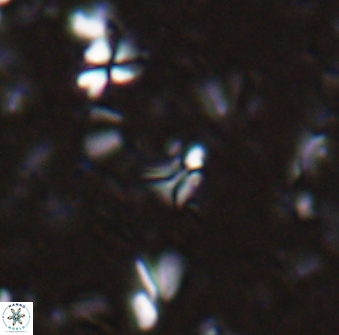 Sphenolithus quasibelemnos 28140