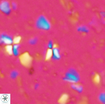 Sphenolithus quasibelemnos 28136