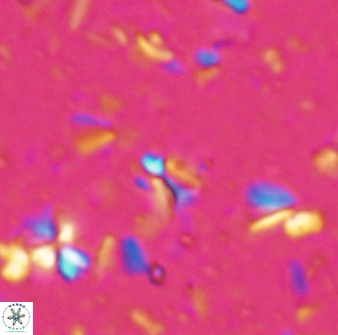 Sphenolithus quasibelemnos 28138