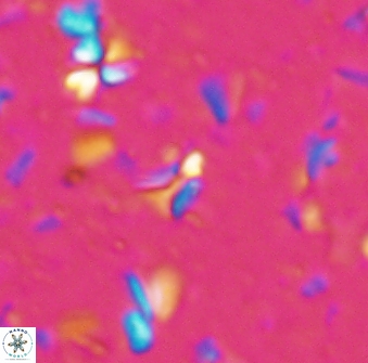 Sphenolithus quasibelemnos 28139